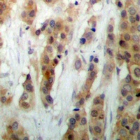 HEXIM1 Antibody