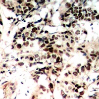 Histone H1 (Phospho-T17) Antibody
