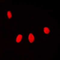 Histone H1 (Phospho-T17) Antibody