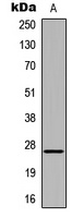 HOXA6 Rabbit Polyclonal Antibody