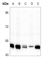 IKK gamma Rabbit Polyclonal Antibody