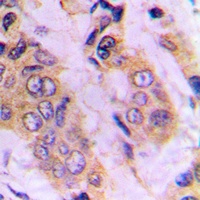 IKK gamma Rabbit Polyclonal Antibody