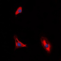 CD210a Antibody