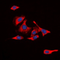 CD213a1 (Phospho-Y405) Antibody