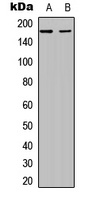 MUC1 Rabbit Polyclonal Antibody