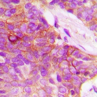 MUC1 Rabbit Polyclonal Antibody