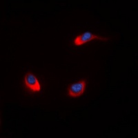 MUC1 Rabbit Polyclonal Antibody