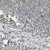 Beta-tubulin Antibody