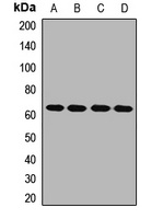 TEC Rabbit Polyclonal Antibody