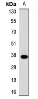 DOK4 Rabbit Polyclonal Antibody