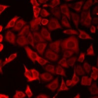 DOK4 Rabbit Polyclonal Antibody