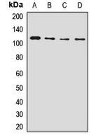 NUP98 Antibody