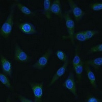 NUP98 Antibody