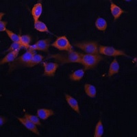 PPP3R1 Antibody