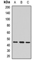 CHRNE Rabbit Polyclonal Antibody