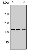PLA2R Rabbit Polyclonal Antibody
