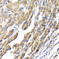 IKAP Rabbit Polyclonal Antibody