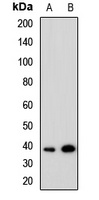 TRIB1 Rabbit Polyclonal Antibody
