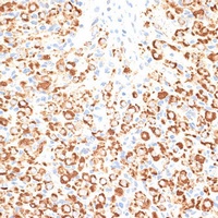 KLHL9 Rabbit Polyclonal Antibody