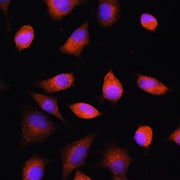 EIF2B5 Rabbit Polyclonal Antibody