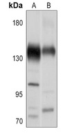 CACNA2D2 Rabbit Polyclonal Antibody