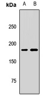 KIF14 Antibody