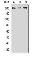 NCOA2 Rabbit Polyclonal Antibody