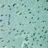 NCOA2 Rabbit Polyclonal Antibody