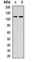 EMC1 Rabbit Polyclonal Antibody