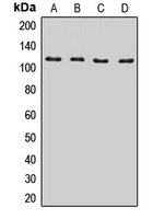 BICD2 Rabbit Polyclonal Antibody