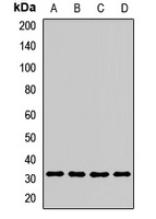 ICMT Rabbit Polyclonal Antibody