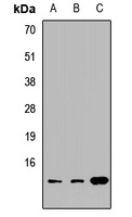 CISD1 Rabbit Polyclonal Antibody