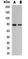 L3MBTL2 Rabbit Polyclonal Antibody