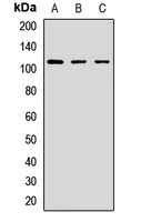 STRIP1 Rabbit Polyclonal Antibody