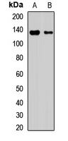 DIAPH3 Rabbit Polyclonal Antibody