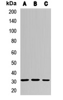 MMACHC Rabbit Polyclonal Antibody