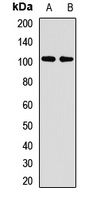 ZC3H14 Rabbit Polyclonal Antibody