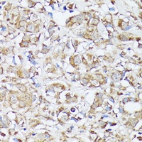 MTHFD2 Antibody
