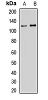 USP28 Rabbit Polyclonal Antibody