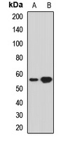 THUMPD3 Rabbit Polyclonal Antibody