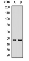 ZIP14 Antibody