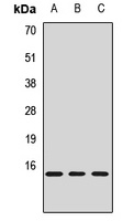 JTB Rabbit Polyclonal Antibody