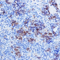 Thymidylate Synthase Rabbit Polyclonal Antibody