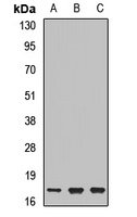 UBE2N Antibody