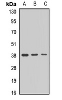 MARCH9 Rabbit Polyclonal Antibody