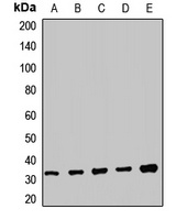 TRMT61A Antibody