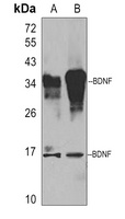 BDNF Rabbit Polyclonal Antibody