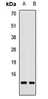 Transthyretin Rabbit Polyclonal Antibody