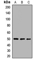 MAGEA4 Rabbit Polyclonal Antibody
