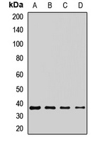 MC3 Receptor Rabbit Polyclonal Antibody
